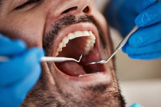 Best Emergency Broken Tooth Repair in Glenmoor, OH